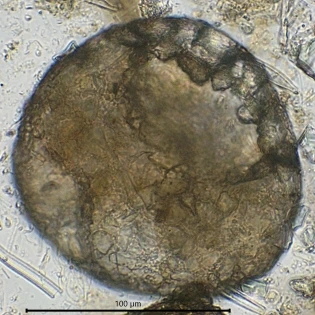 Centropyxis constricta