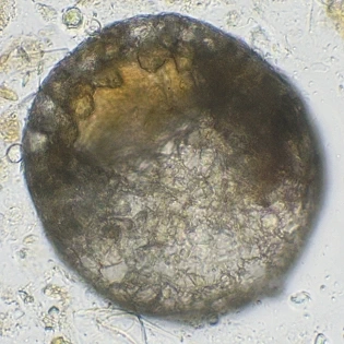 Centropyxis constricta