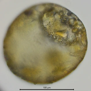 Centropyxis constricta