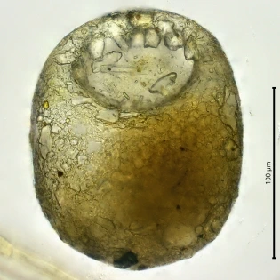 Centropyxis constricta