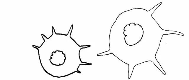 Centropyxis dentistoma