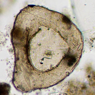 Centropyxis discoides