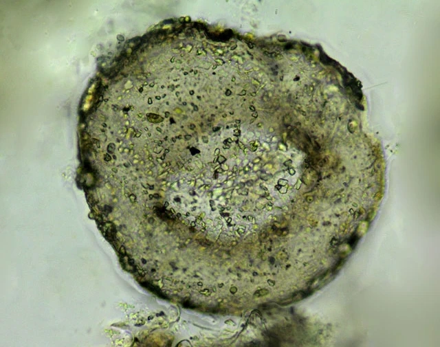 Centropyxis discoides