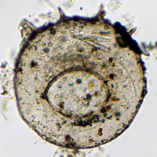 Centropyxis discoides