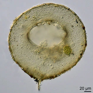 Centropyxis discoides
