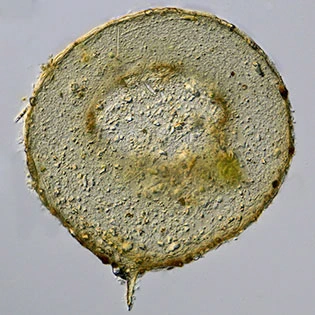 Centropyxis discoides