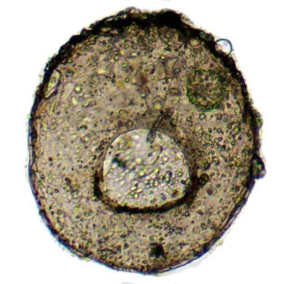Centropyxis discoides