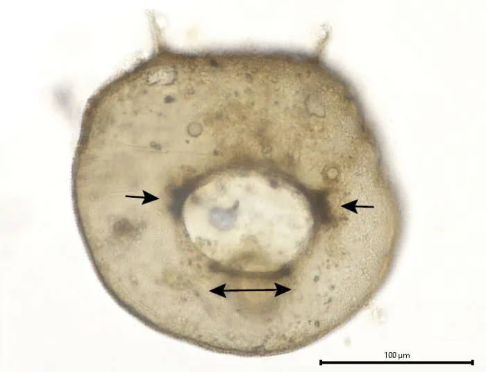 Centropyxis discoides