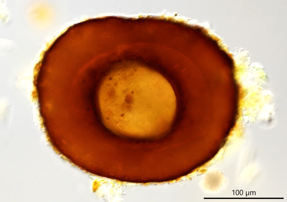 Centropyxis discoides