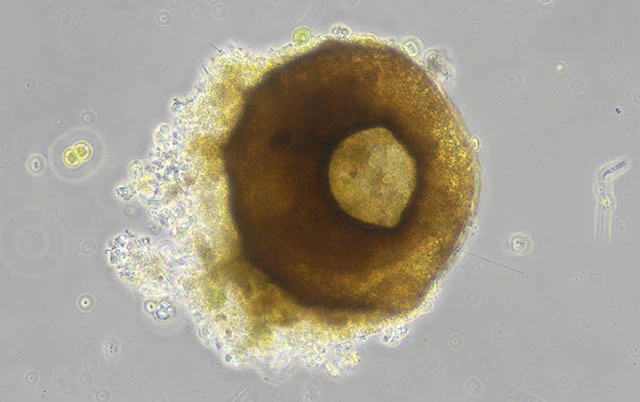 Centropyxis discoides