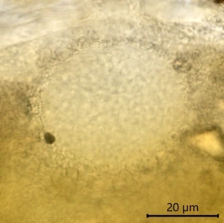 Centropyxis discoides