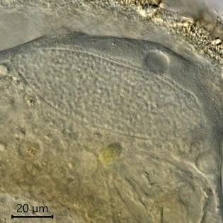 Centropyxis discoides