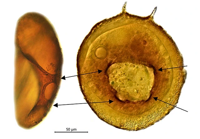 Centropyxis discoides