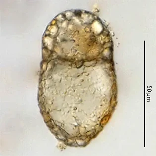 Centropyxis elongata