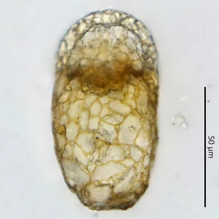 Centropyxis elongata