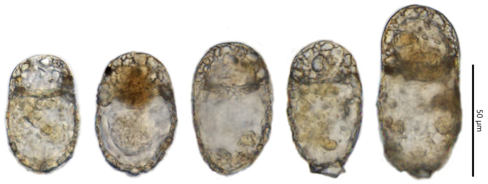 Centropyxis elongata