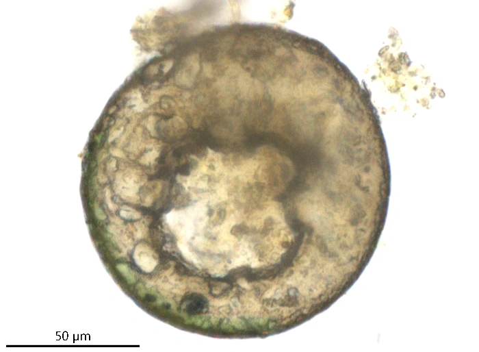 Centropyxis lapponica