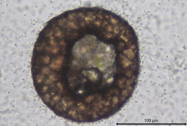 Centropyxis lapponica