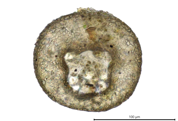 Centropyxis lapponica