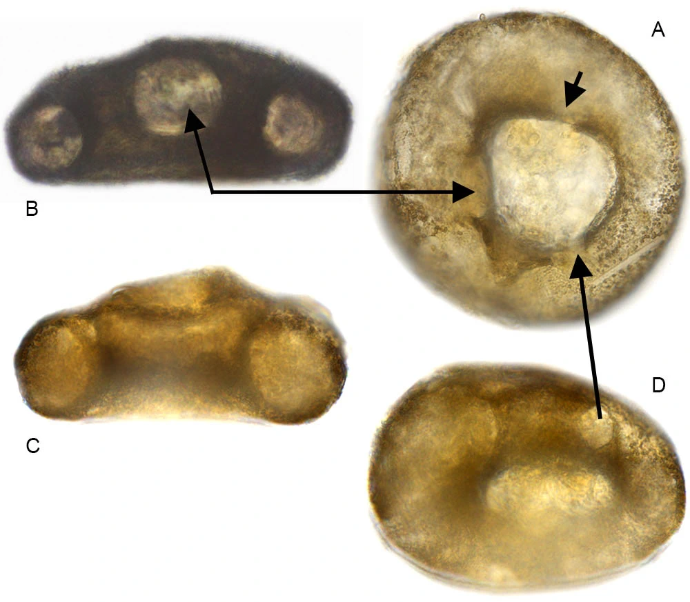 Centropyxis lapponica
