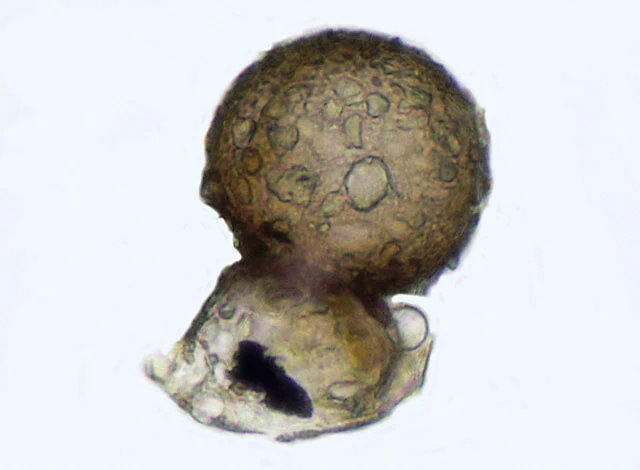 Centropyxis pontigulasiformis