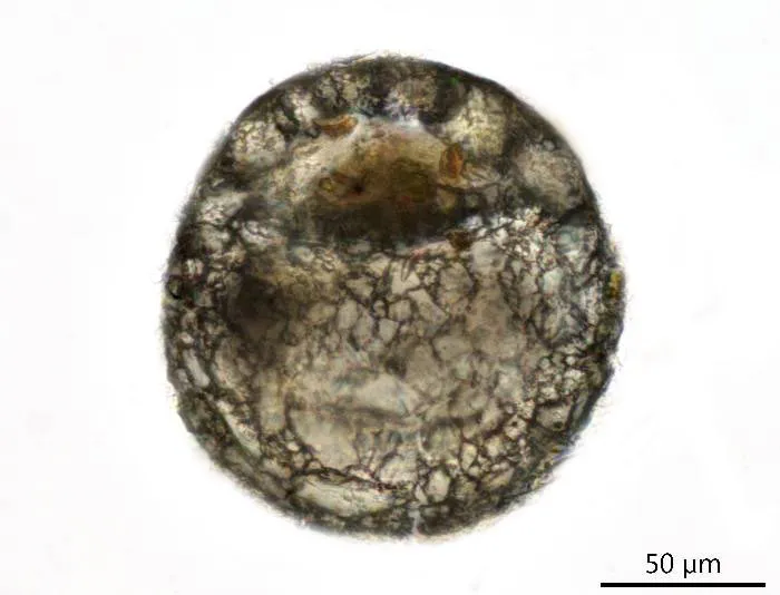 Centropyxis orbicularis