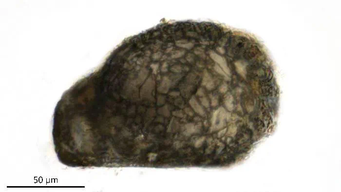 Centropyxis orbicularis