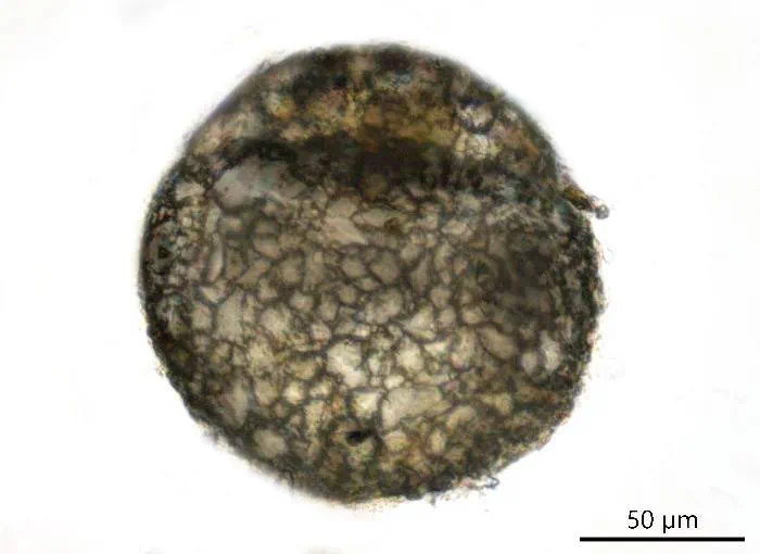 Centropyxis orbicularis
