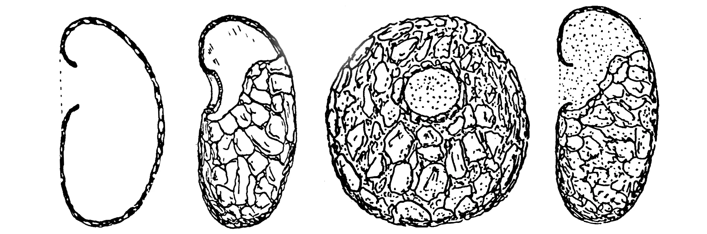 Centropyxis plagiostoma