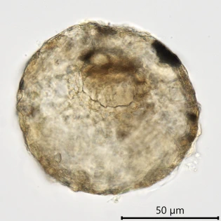 Centropyxis plagiostoma