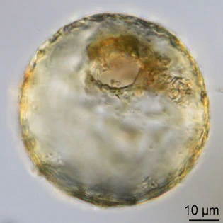 Centropyxis plagiostoma