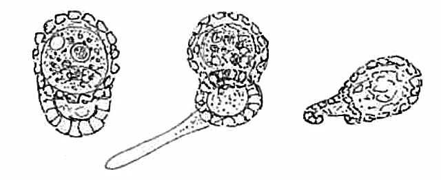 Centropyxis platystoma