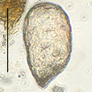 Plagiopyxis labiata