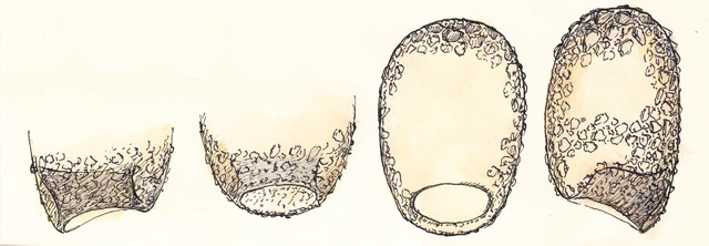 Centropyxis sacciformis