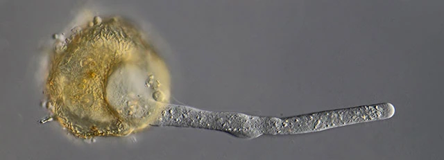 Centropyxis