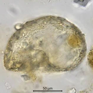 Centropyxis constricta