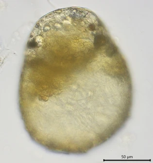 Centropyxis constricta