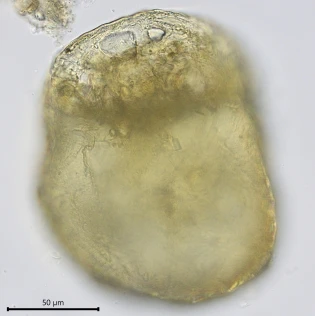 Centropyxis constricta