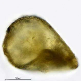 Centropyxis constricta