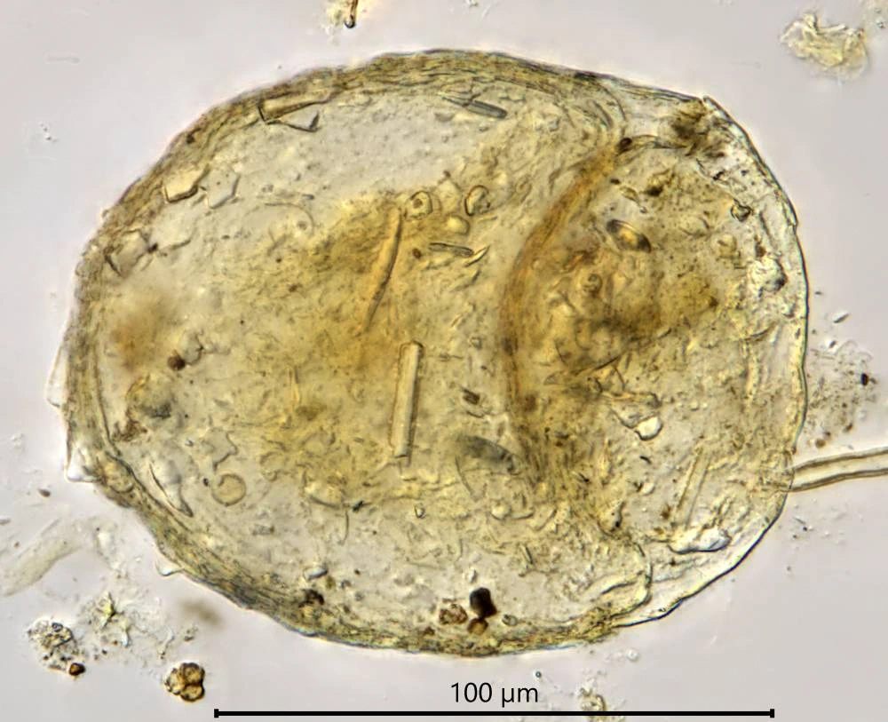 Centropyxis constricta