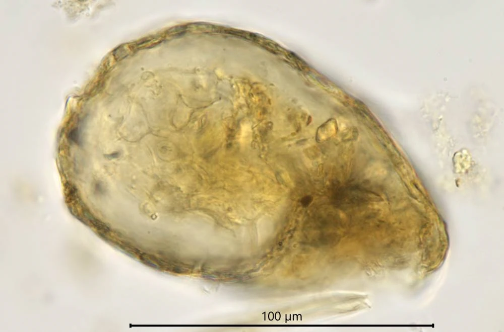 Centropyxis constricta