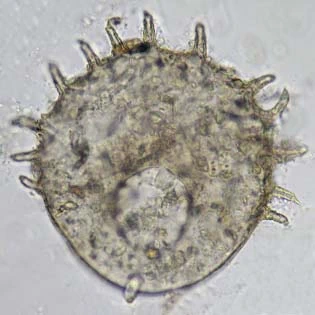 Centropyxis spinosa