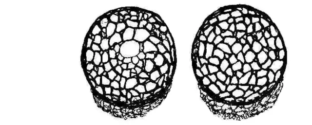 Centropyxis stolata
