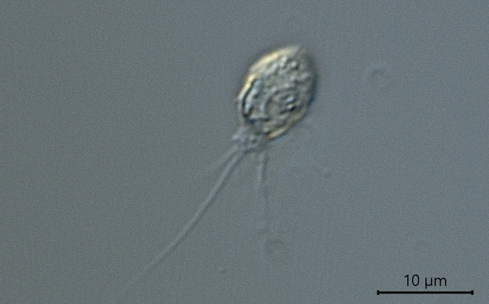 Pseudodifflugia spec.