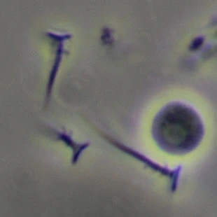 Choanocystis aculeata - Ferry Siemensma
