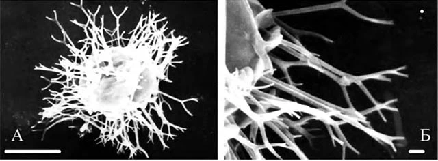 Choanocystis bicornioides