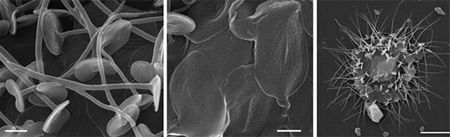 Choanocystis punctata