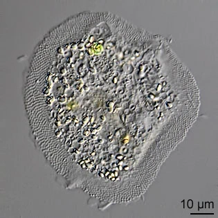 Cochliopodium