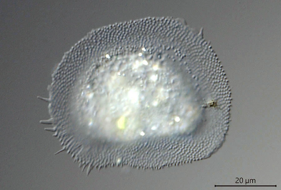 Cochliopodium cf bilimbosum