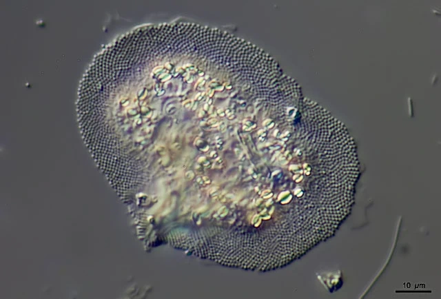 Cochliopodium bilimbosum
